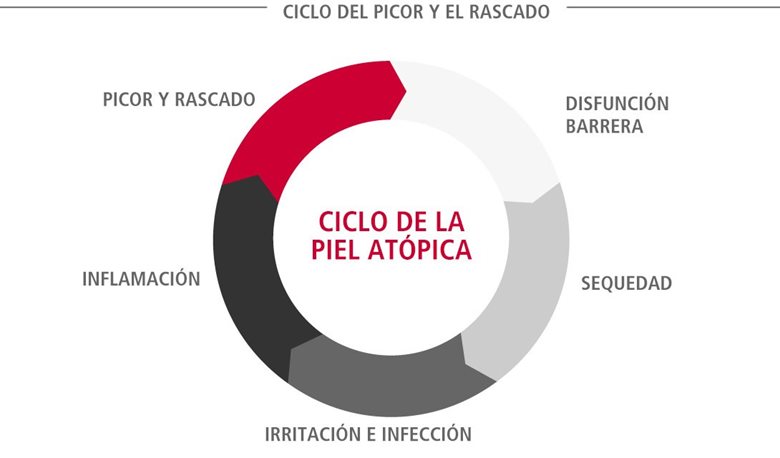 Ciclo de la piel atópica (conocido también como el ciclo del picor y el rascado)